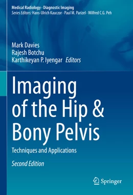 Abbildung von Davies / Botchu | Imaging of the Hip & Bony Pelvis | 2. Auflage | 2024 | beck-shop.de