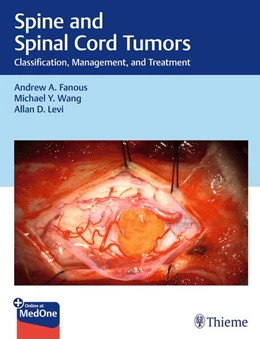 Abbildung von Fanous / Wang | Spine and Spinal Cord Tumors | 1. Auflage | 2025 | beck-shop.de