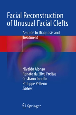 Abbildung von Alonso / Freitas | Facial Reconstruction of Unusual Facial Clefts | 1. Auflage | 2024 | beck-shop.de