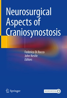 Abbildung von Di Rocco / Kestle | Neurosurgical Aspects of Craniosynostosis | 1. Auflage | 2025 | beck-shop.de