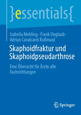 Abbildung von Mehling / Unglaub | Skaphoidfraktur und Skaphoidpseudarthrose | 1. Auflage | 2025 | beck-shop.de