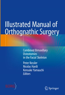 Abbildung von Kessler / Hardt | Illustrated Manual of Orthognathic Surgery | 1. Auflage | 2025 | beck-shop.de