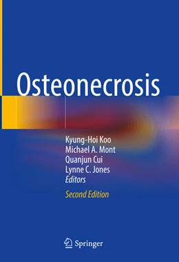 Abbildung von Koo / Mont | Osteonecrosis | 2. Auflage | 2025 | beck-shop.de