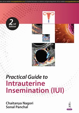 Abbildung von Nagori / Panchal | Practical Guide to Intrauterine Insemination (IUI) | 2. Auflage | 2024 | beck-shop.de