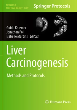 Abbildung von Kroemer / Pol | Liver Carcinogenesis | 1. Auflage | 2025 | 2769 | beck-shop.de