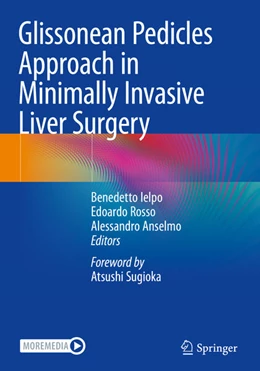 Abbildung von Ielpo / Rosso | Glissonean Pedicles Approach in Minimally Invasive Liver Surgery | 1. Auflage | 2025 | beck-shop.de