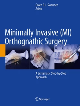 Abbildung von Swennen | Minimally Invasive (MI) Orthognathic Surgery | 1. Auflage | 2024 | beck-shop.de