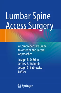 Abbildung von O'Brien / Weinreb | Lumbar Spine Access Surgery | 1. Auflage | 2025 | beck-shop.de