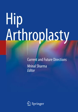 Abbildung von Sharma | Hip Arthroplasty | 1. Auflage | 2025 | beck-shop.de