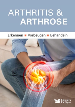 Abbildung von Arthritis & Arthrose | 1. Auflage | 2025 | beck-shop.de