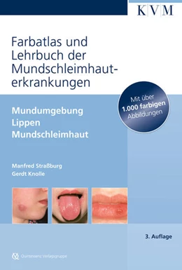 Abbildung von Straßburg / Knolle | Farbatlas und Lehrbuch der Mundschleimhauterkrankungen | 3. Auflage | 2010 | beck-shop.de