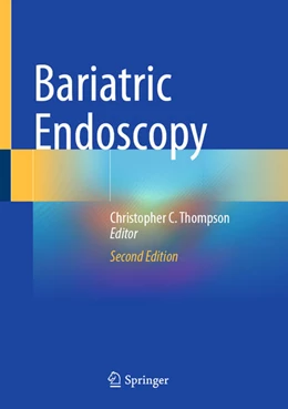 Abbildung von Thompson | Bariatric Endoscopy | 2. Auflage | 2025 | beck-shop.de