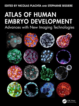 Abbildung von Plachta / Bissiere | Atlas of Human Embryo Development | 1. Auflage | 2025 | beck-shop.de