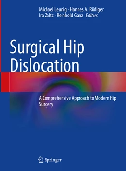 Abbildung von Leunig / Rüdiger | Surgical Hip Dislocation | 1. Auflage | 2025 | beck-shop.de