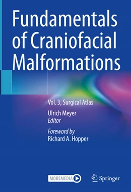 Abbildung von Meyer | Fundamentals of Craniofacial Malformations | 1. Auflage | 2025 | beck-shop.de