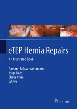 Abbildung von Balasubramaniam / Daes | eTEP Hernia Repairs | 1. Auflage | 2025 | beck-shop.de