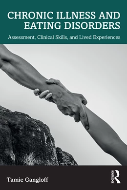 Abbildung von Gangloff | Chronic Illness and Eating Disorders | 1. Auflage | 2025 | beck-shop.de