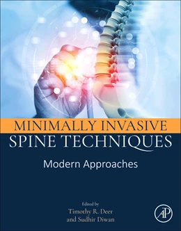 Abbildung von Deer / Diwan | Minimally Invasive Spine Techniques | 1. Auflage | 2026 | beck-shop.de