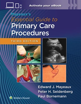 Abbildung von MAYEAUX / BORNEMANN | Mayeaux's Essential Guide to Primary Care Procedures: Print + eBook with Multimedia | 3. Auflage | 2025 | beck-shop.de