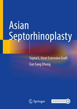 Abbildung von Dhong | Asian Septorhinoplasty | 1. Auflage | 2025 | beck-shop.de