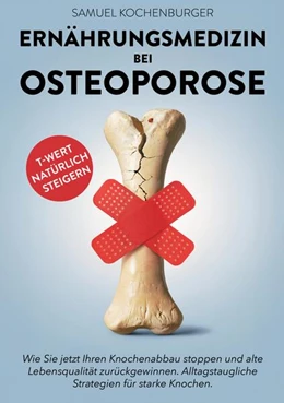 Abbildung von Kochenburger | Ernährungsmedizin bei Osteoporose | 1. Auflage | 2025 | beck-shop.de