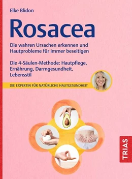 Abbildung von Blidon | Rosacea | 1. Auflage | 2025 | beck-shop.de