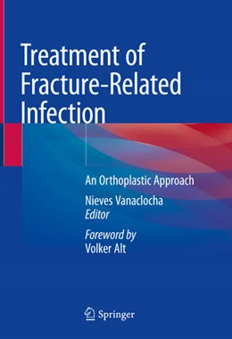 Abbildung von Vanaclocha | Treatment of Fracture-Related Infection | 1. Auflage | 2025 | beck-shop.de