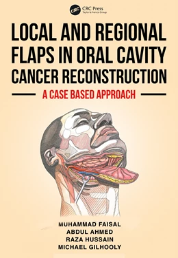 Abbildung von Ahmed / Gilhooly | Local and Regional Flaps in Oral Cavity Cancer Reconstruction | 1. Auflage | 2025 | beck-shop.de