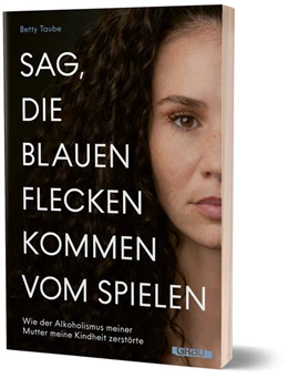 Abbildung von Taube | Sag, die blauen Flecken kommen vom Spielen | 1. Auflage | 2025 | beck-shop.de