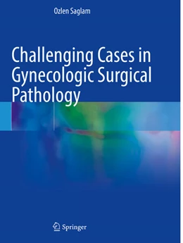 Abbildung von Saglam | Challenging Cases in Gynecologic Surgical Pathology | 1. Auflage | 2025 | beck-shop.de