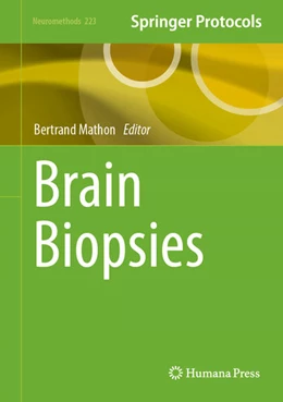 Abbildung von Mathon | Brain Biopsies | 1. Auflage | 2025 | beck-shop.de