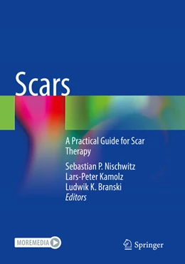Abbildung von Nischwitz / Kamolz | Scars | 1. Auflage | 2025 | beck-shop.de