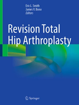 Abbildung von Smith / Bono | Revision Total Hip Arthroplasty | 1. Auflage | 2025 | beck-shop.de