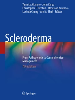 Abbildung von Allanore / Varga | Scleroderma | 3. Auflage | 2025 | beck-shop.de