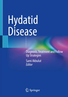Abbildung von Akbulut | Hydatid Disease | 1. Auflage | 2025 | beck-shop.de