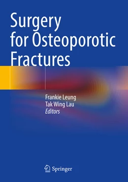 Abbildung von Leung / Lau | Surgery for Osteoporotic Fractures | 1. Auflage | 2025 | beck-shop.de