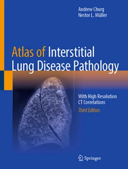 Abbildung von Churg / Müller | Atlas of Interstitial Lung Disease Pathology | 3. Auflage | 2025 | beck-shop.de