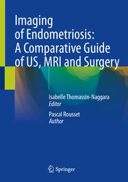 Abbildung von Thomassin-Naggara | Imaging of Endometriosis: A Comparative Guide of US, MRI and Surgery | 1. Auflage | 2025 | beck-shop.de