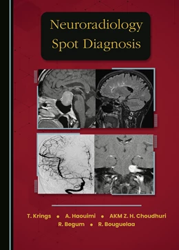 Abbildung von Krings / Haouimi | Neuroradiology Spot Diagnosis | 1. Auflage | 2025 | beck-shop.de