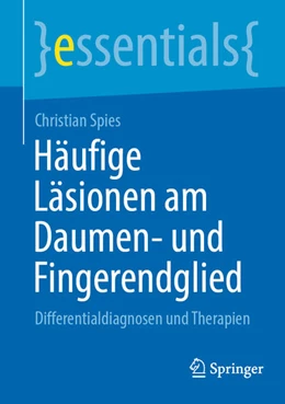Abbildung von Spies | Häufige Läsionen am Daumen- und Fingerendglied | 1. Auflage | 2025 | beck-shop.de