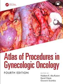 Abbildung von Cibula / Scambia | Atlas of Procedures in Gynecologic Oncology | 4. Auflage | 2025 | beck-shop.de