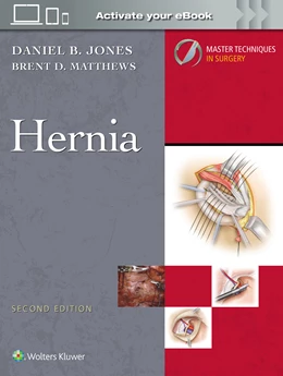 Abbildung von JONES / Matthews | Master Techniques in Surgery: Hernia: Print + eBook with Multimedia | 2. Auflage | 2025 | beck-shop.de