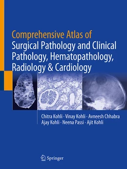 Abbildung von Kohli / Chhabra | Comprehensive Atlas of Surgical Pathology and Clinical Pathology, Hematopathology, Radiology & Cardiology | 1. Auflage | 2026 | beck-shop.de
