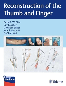 Abbildung von Chiu / Foucher | Reconstruction of the Thumb and Finger | 1. Auflage | 2025 | beck-shop.de