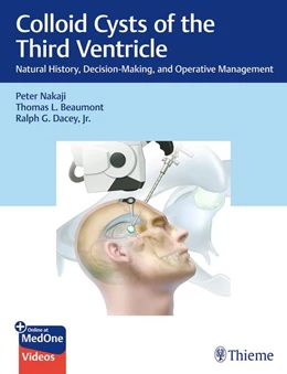 Abbildung von Nakaji / Beaumont | Colloid Cysts of the Third Ventricle | 1. Auflage | 2025 | beck-shop.de