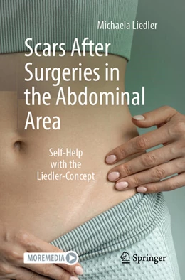 Abbildung von Liedler | Scars After Surgeries in the Abdominal Area | 1. Auflage | 2025 | beck-shop.de