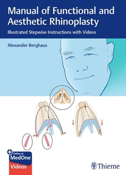 Abbildung von Berghaus | Manual of Functional and Aesthetic Rhinoplasty | 1. Auflage | 2025 | beck-shop.de