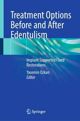 Abbildung von Ozkan | Treatment Options Before and After Edentulism | 1. Auflage | 2025 | beck-shop.de