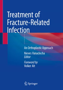 Abbildung von Vanaclocha | Treatment of Fracture-Related Infection | 1. Auflage | 2025 | beck-shop.de