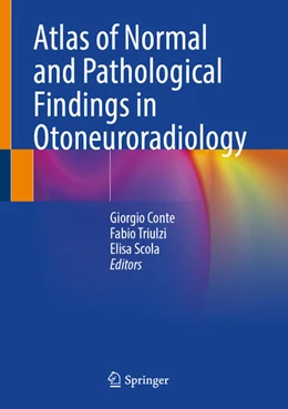 Abbildung von Conte / Triulzi | Atlas of Normal and Pathological Findings in Otoneuroradiology | 1. Auflage | 2025 | beck-shop.de
